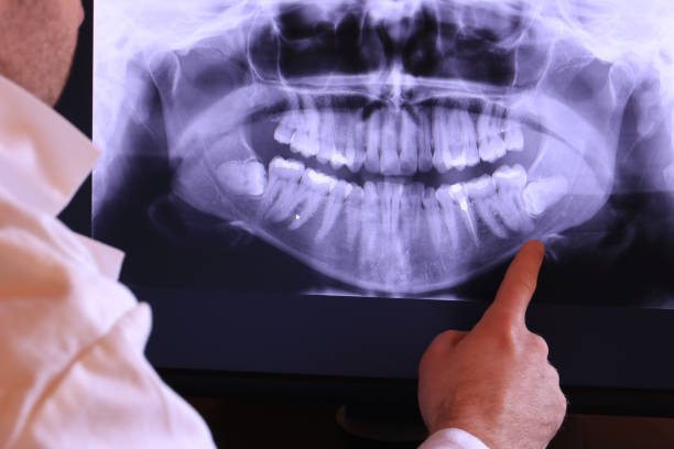 Best Knocked-Out Tooth Emergency  in New Rochelle, NY