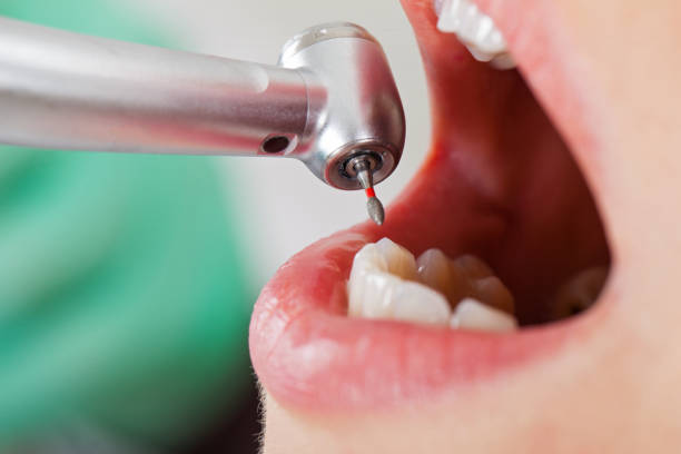 Best Root Canal Emergency Dentist  in New Rochelle, NY